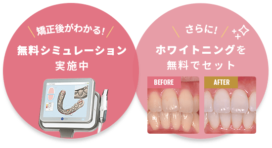 矯正後がわかる無料シミュレーション実施中/さらにホワイトニングを無料でセット